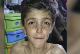 Children Are Starving To Death In Madaya, Syria - VIDEO